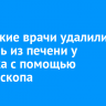 Иркутские врачи удалили опухоль из печени у ребенка с помощью лапароскопа