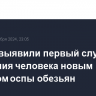 В США выявили первый случай заражения человека новым штаммом оспы обезьян