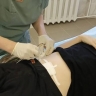 В Башкирии медики спасли девушку с геморрагическим шоком