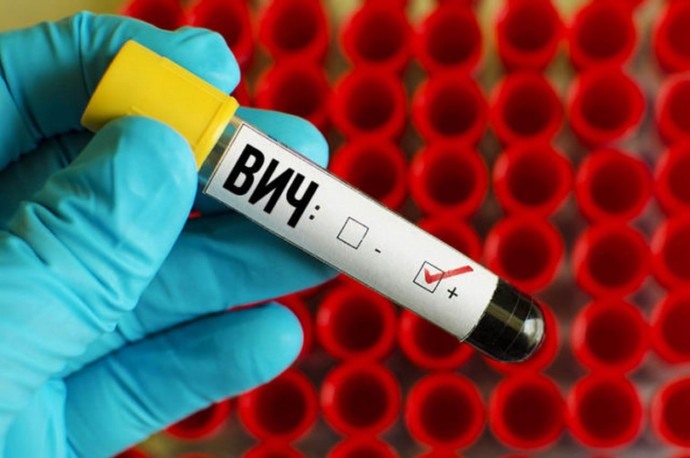 ​В России каждый сотый человек заражен ВИЧ