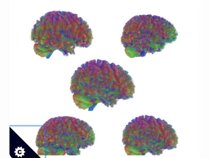 Учёные выделили пять возрастных этапов развития человеческого мозга
